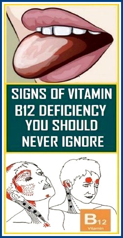 Everything You Need to Know About Vitamin B12 post thumbnail image