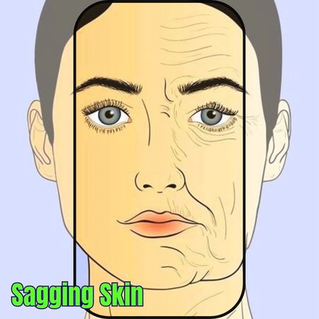 Home Remedies for Sagging Skin